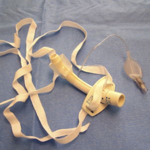 tracheostomy