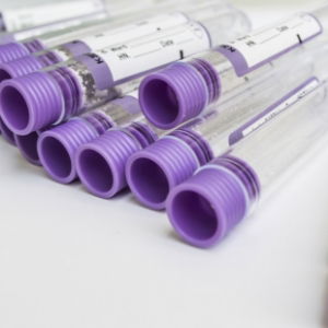 vacutainer tubes